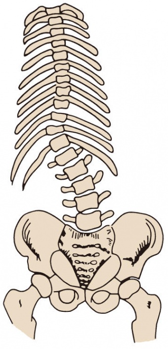 胸腰椎脊柱侧凸.jpg